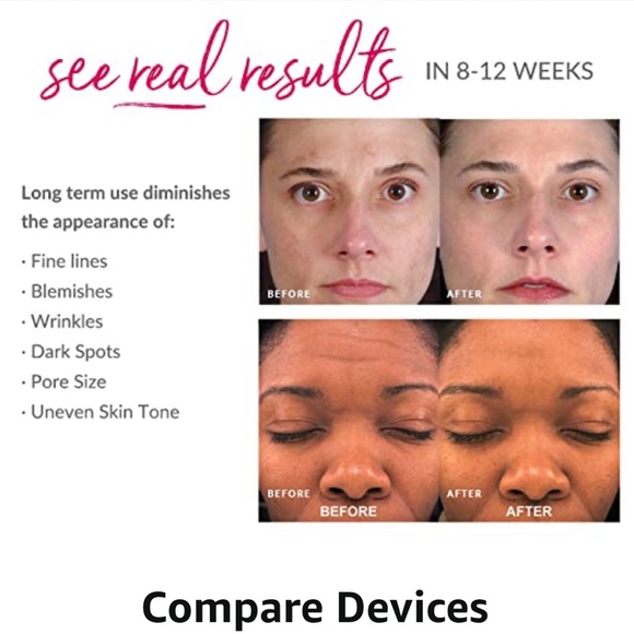 New PMD Personal Microderm Classic - At-Home Microdermabrasion Device (Pink) - Picture 8 of 9